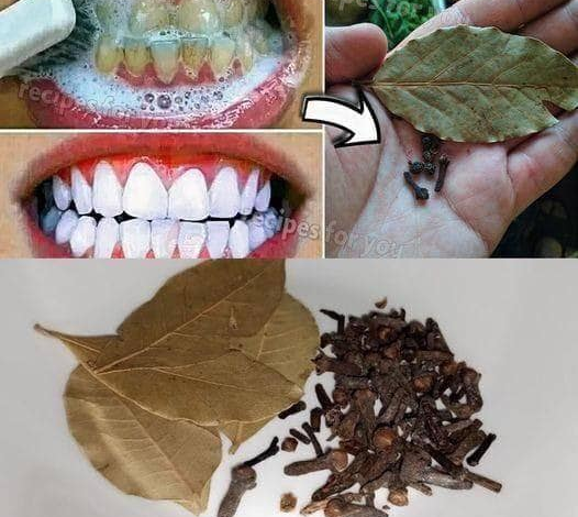 Consiga una sonrisa más brillante de forma natural con clavo y hojas de laurel