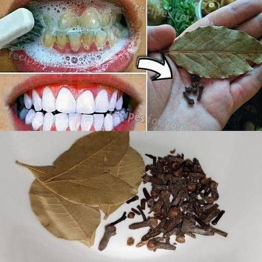 Consiga una sonrisa más brillante de forma natural con clavo y hojas de laurel